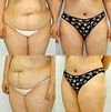 Plastic Surgery Plastic Surgery
